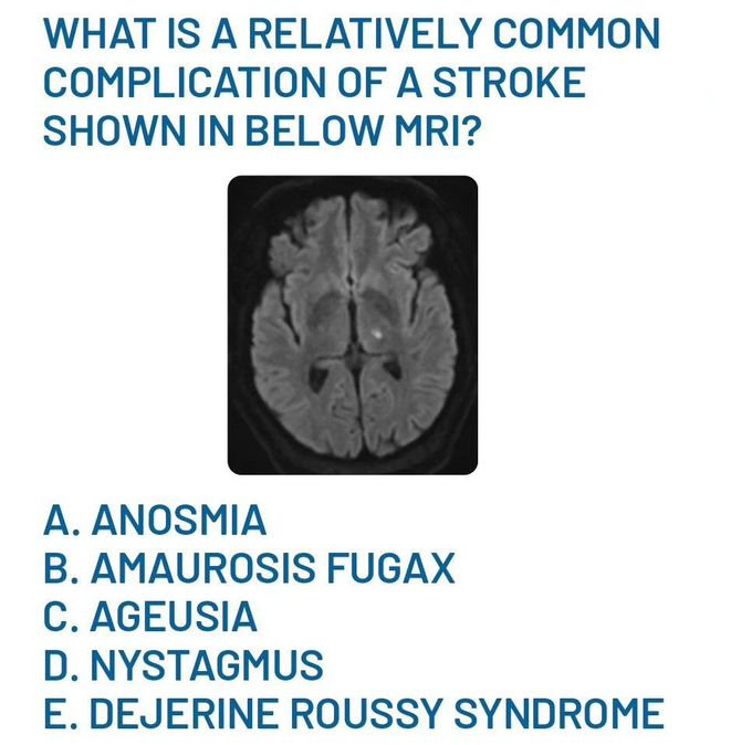 Complication of Stroke