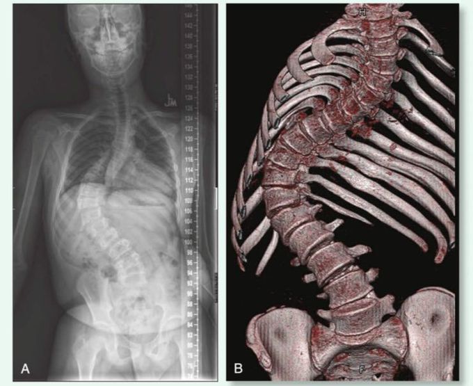 Different case of medical histry