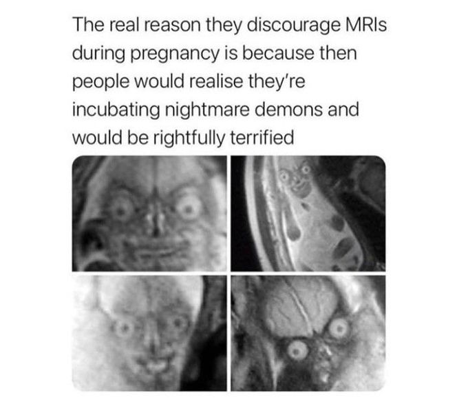 MRI during pregnancy