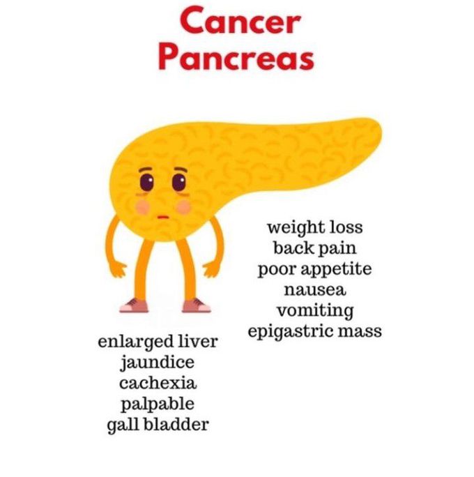 Pancreas cancer