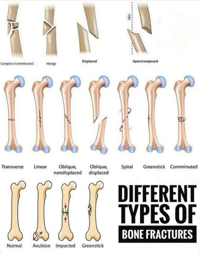 Learning material