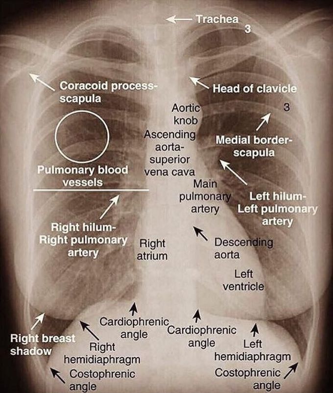 Thoracic radiography - MEDizzy