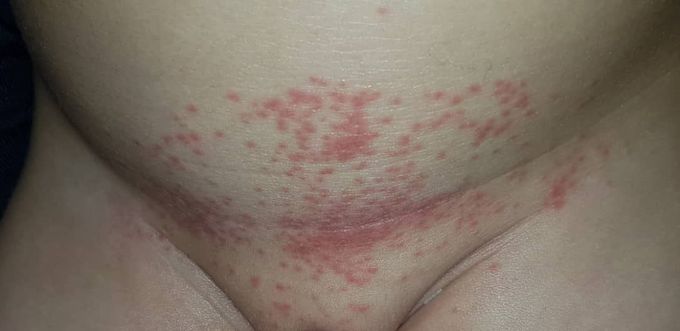 What is your dx?