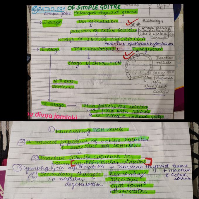 I have written pathology of simple goitre. Go ahead and have a look