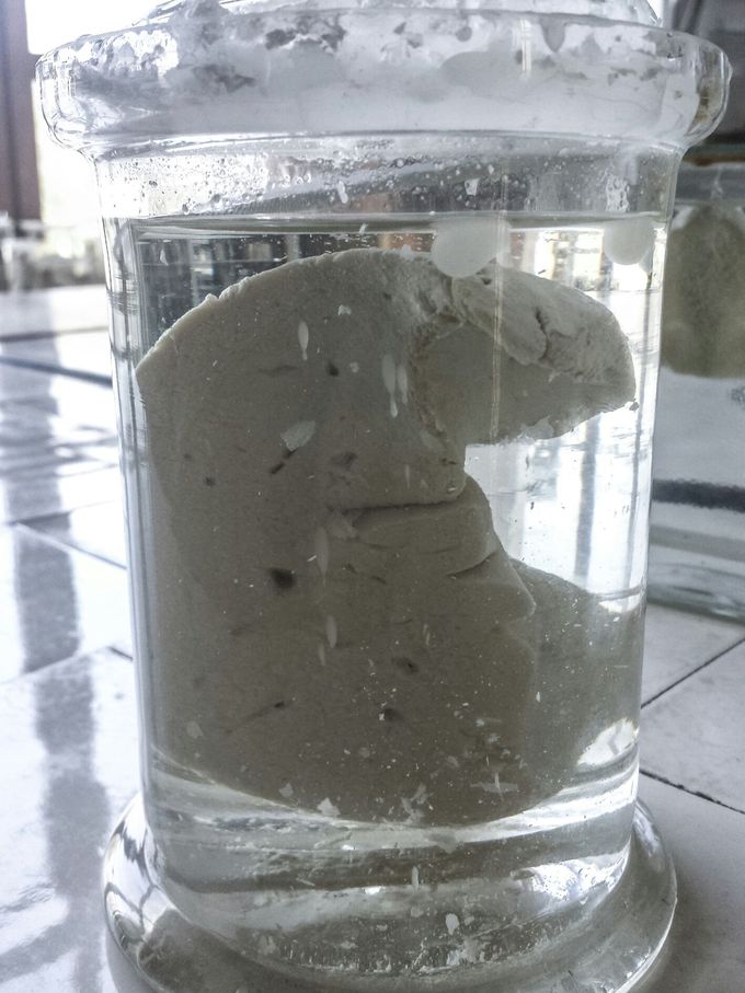 Fatty liver