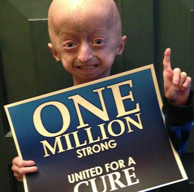 raredisease