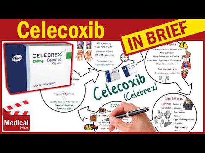 Celecoxib (Selective COX Inhibitor)