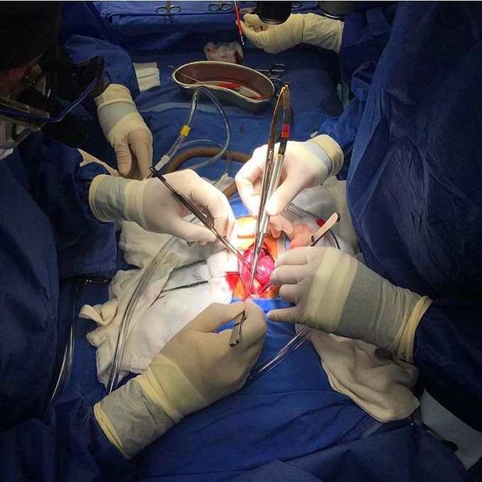 Open heart surgery on a 7 year old female with Down syndrome suffering from an atrioventricular (AV) septal defect