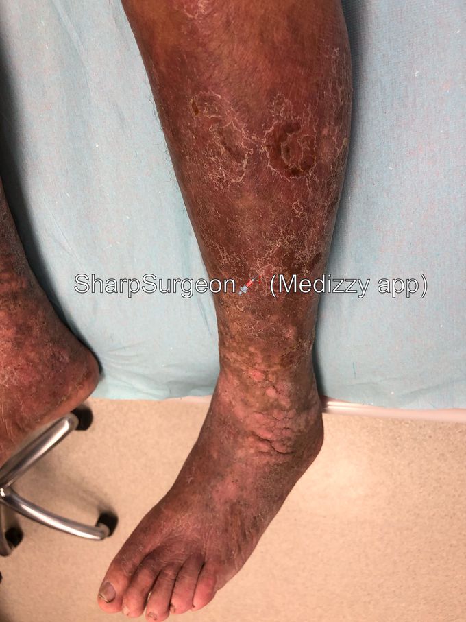 Diagnosis? 🤔