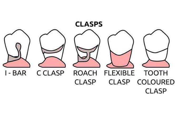 Types of clasps in RPD(Removable partial denture)