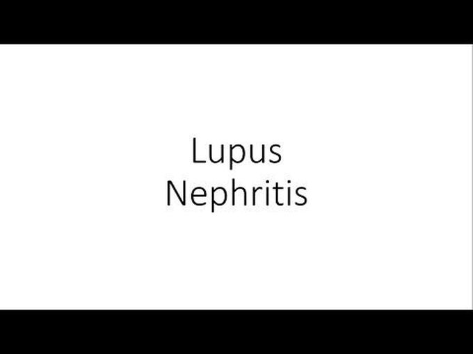 What is Lupus nephritis-Pathogenesis
