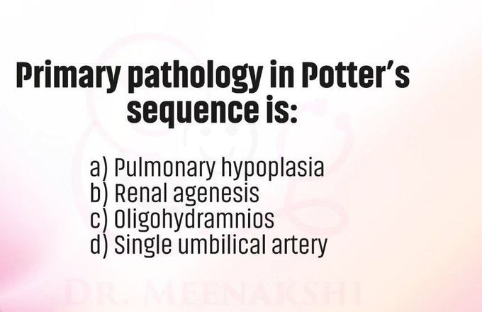 Potter's Sequence