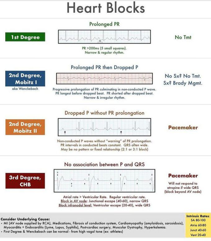 Heart block-degrees