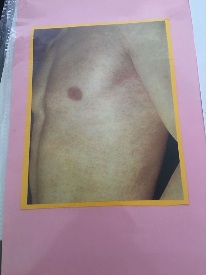 Guess the diagnosis?