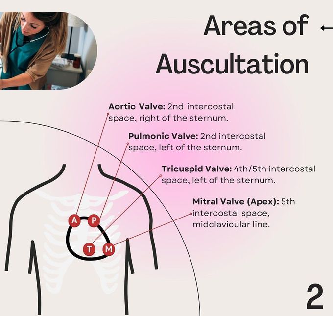 Heart Auscultation II