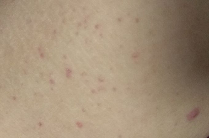 Diagnosis?
