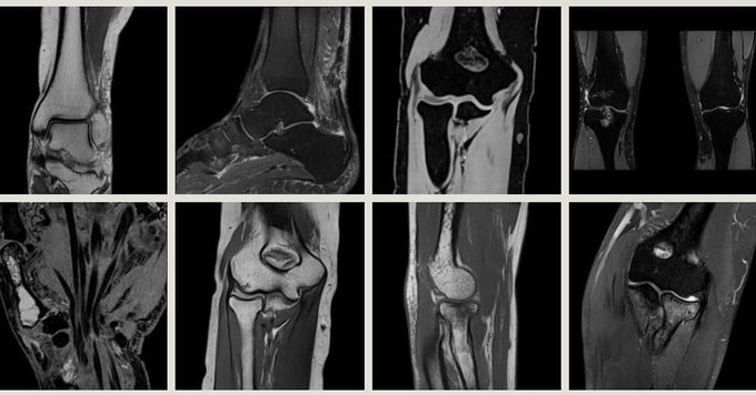 Musculoskeletal Magnetic Resonance Imaging.