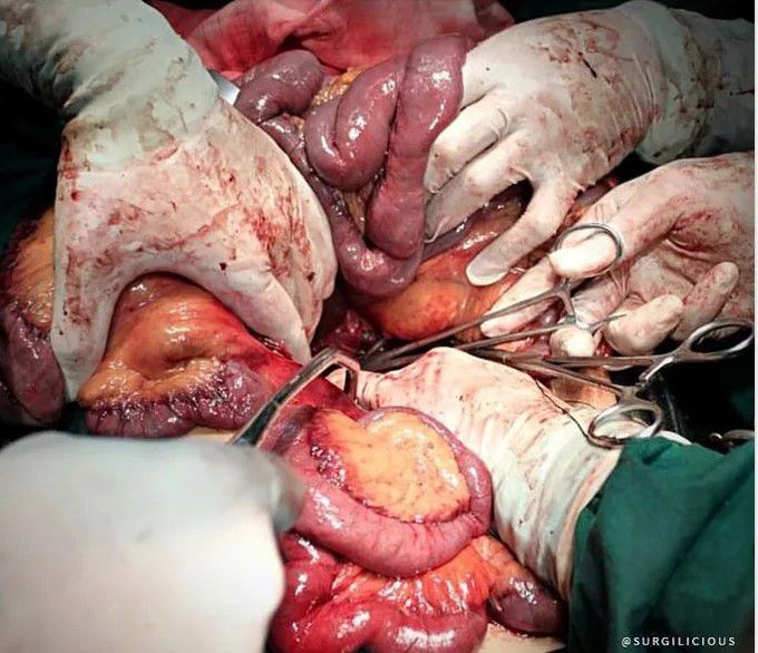 general surgery