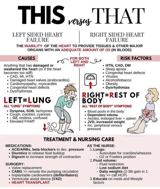 Right Sided Heart Failure Vs Left Sided Heart Failure