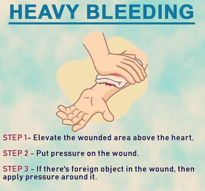 What to do during emergency