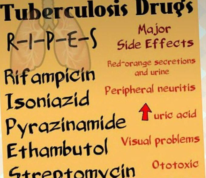 Tuberculosis