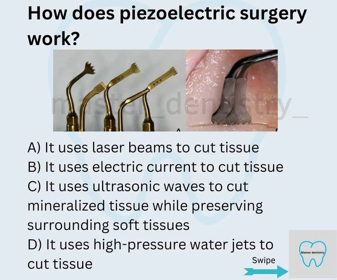 Piezoelectric Surgery