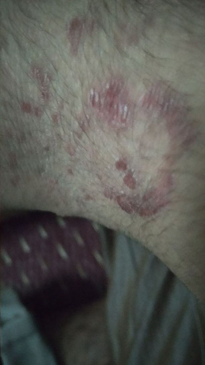 What is your diagnosis and therapeutic treatment?