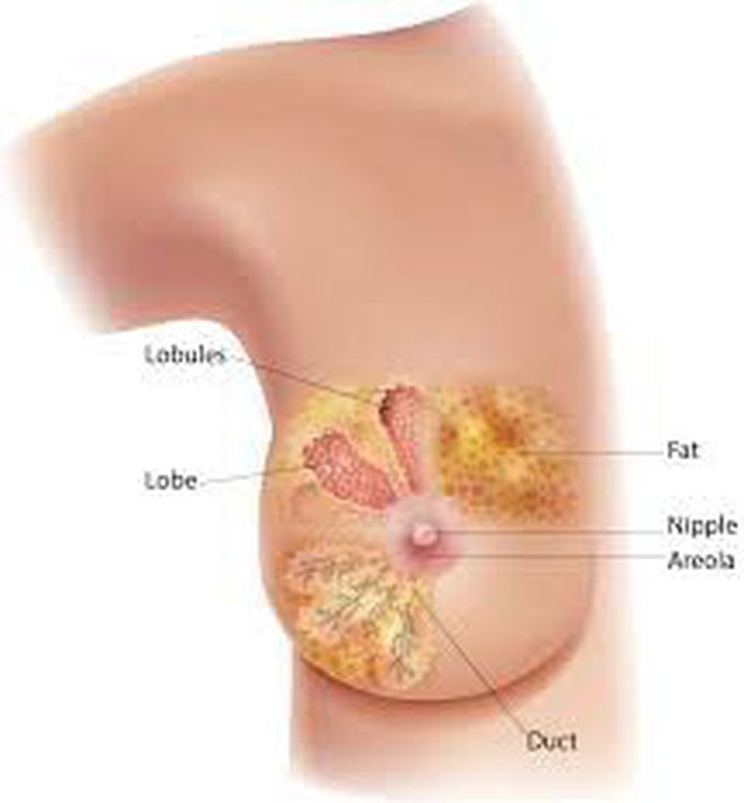 How is breast cancer diagnosed?