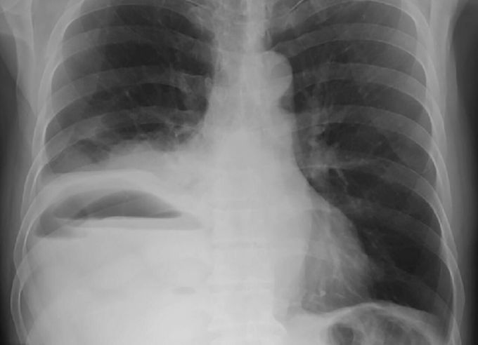 Diagnosis???