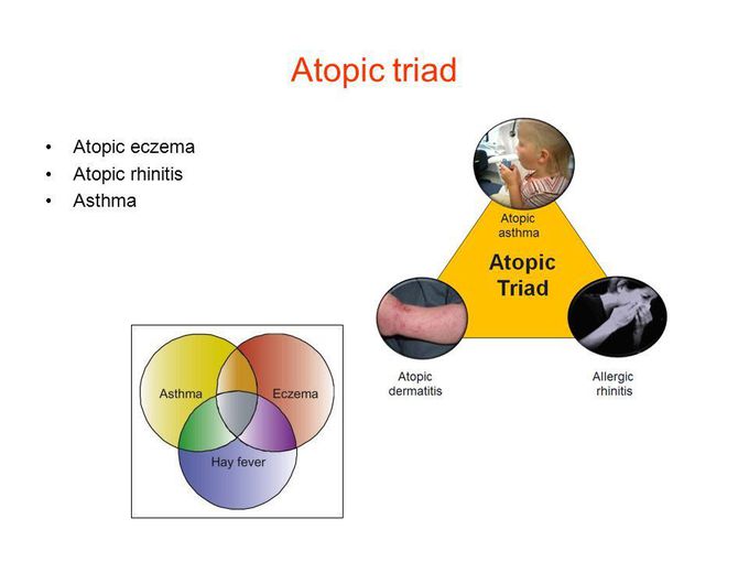 Atopic eczema