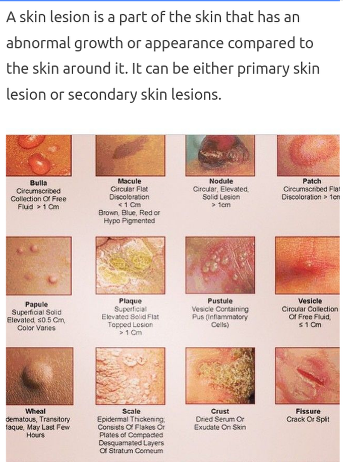 primary skin lesions chart