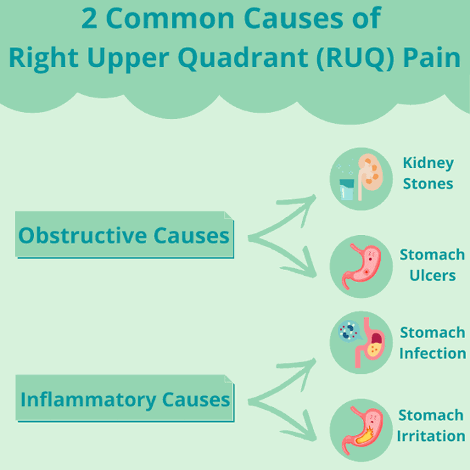 These are the common causes of RUQ