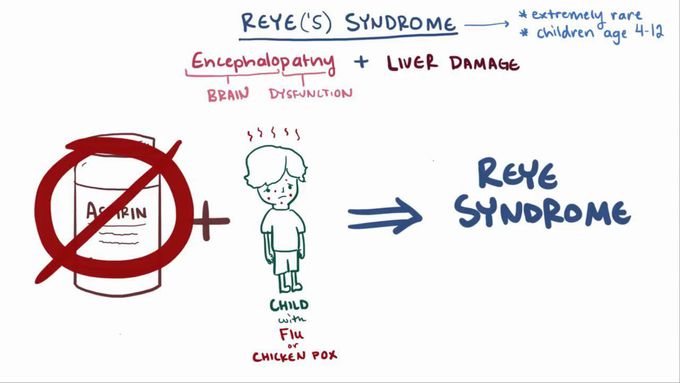 Reye syndrome