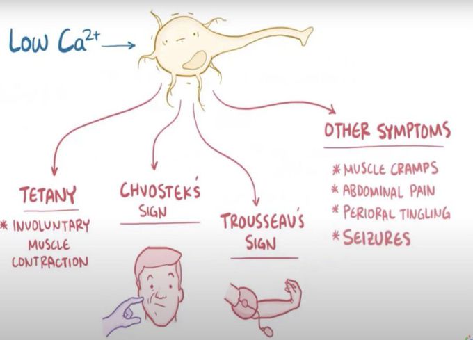 hypoparathyroidism symptoms