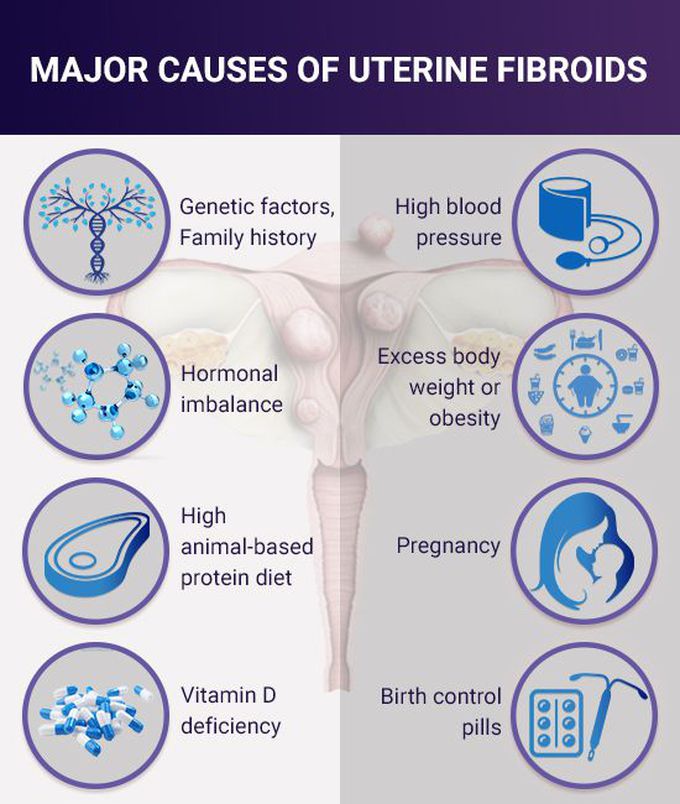 Causes of Uterine fibroids