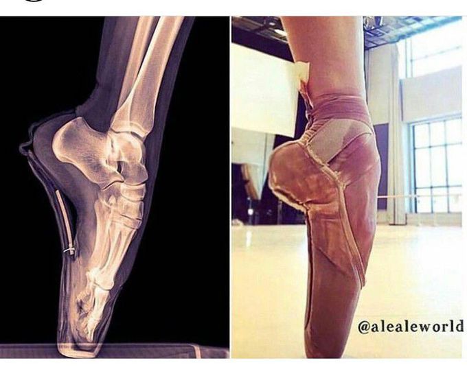 It's  amazing what our bodies can handle 😎😄