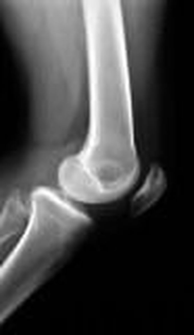 Its normal ? - MEDizzy