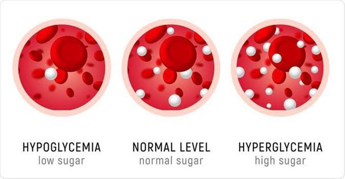 What is hyperglycemia?