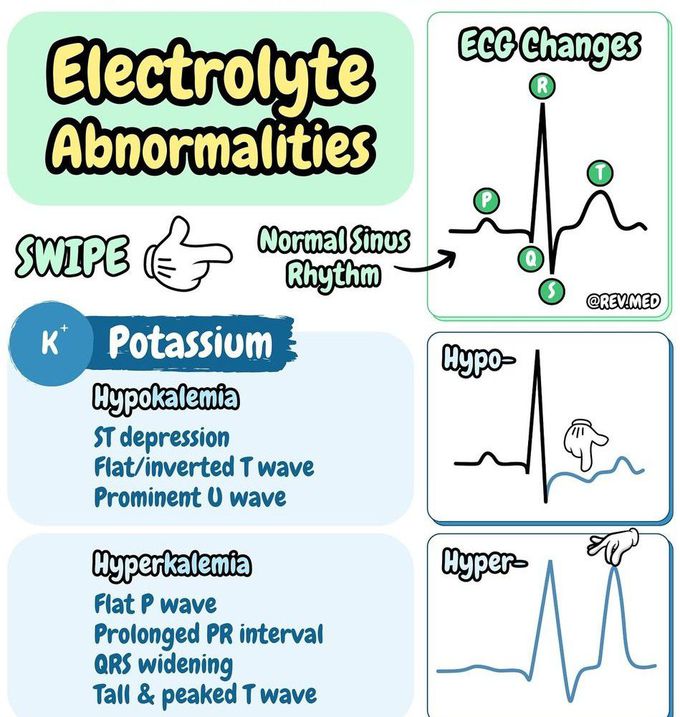 Electrolyte Abnormalities