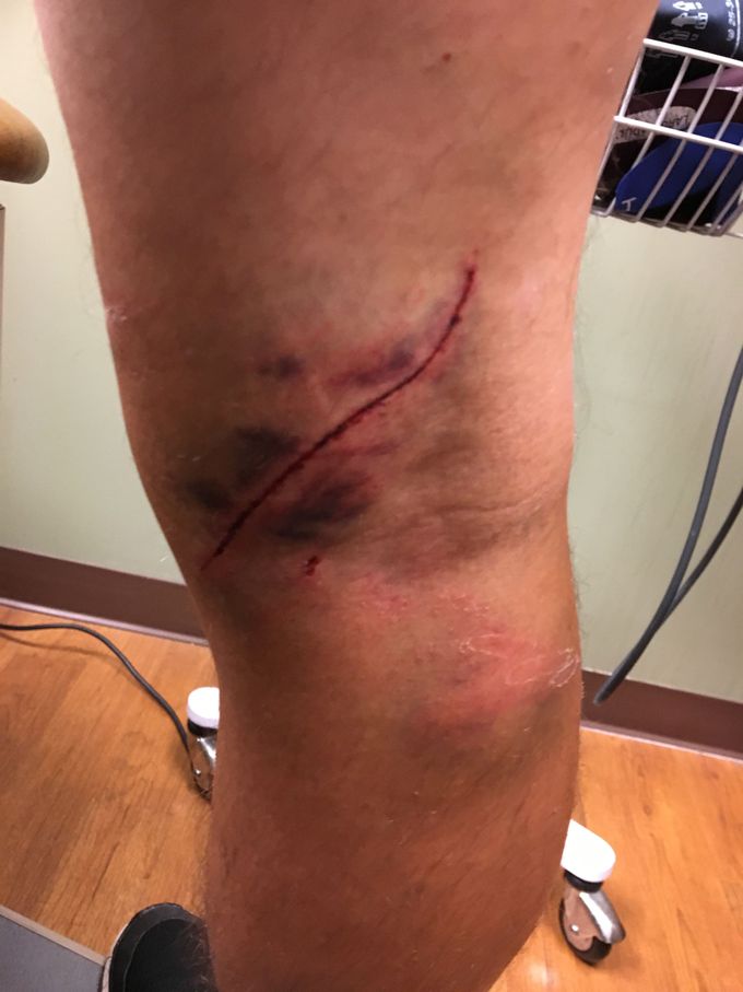 Step-father's leg: What's your diagnoses?