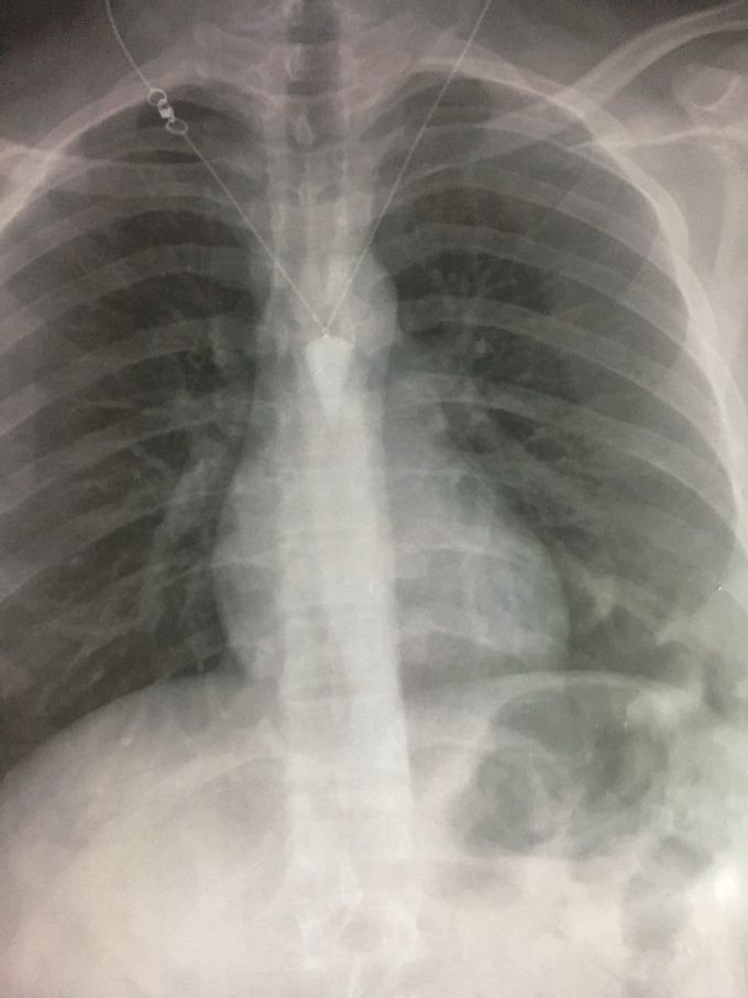 Diagnosis?