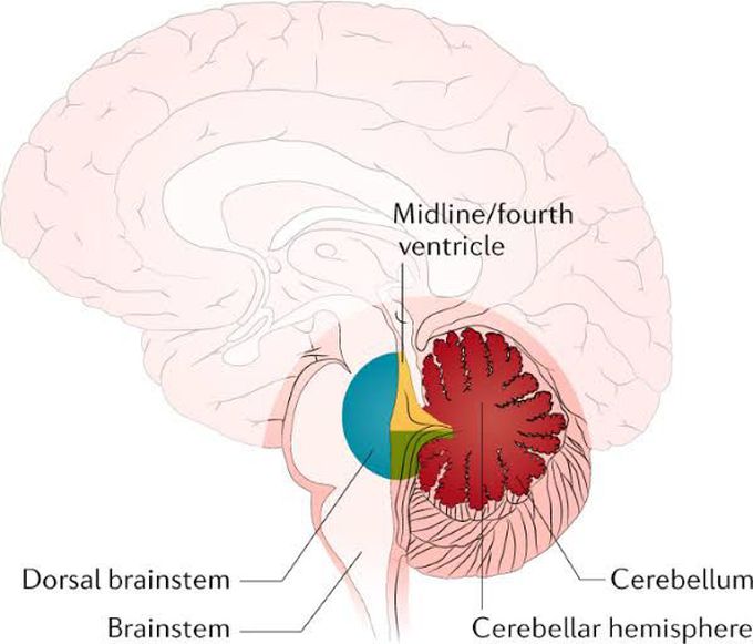 Medullablastoma