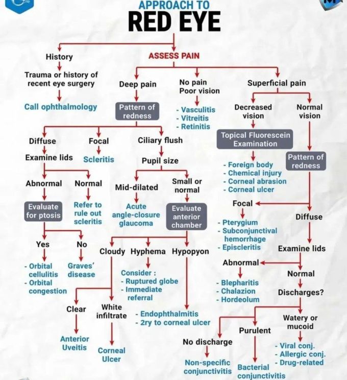 Res Eye Approaches