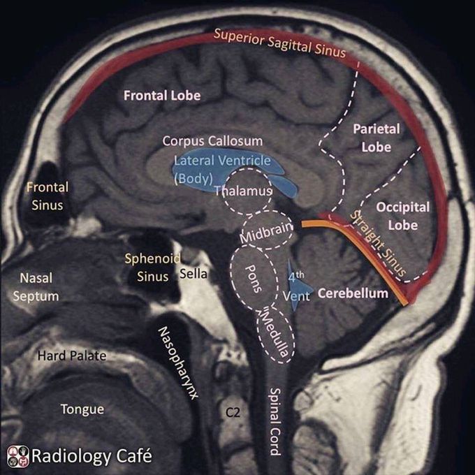 Parts of brain 😅