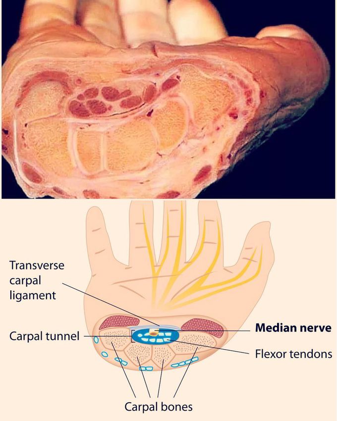Cross section of the wrist
