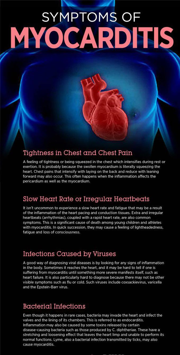 Symptoms of Myocarditis