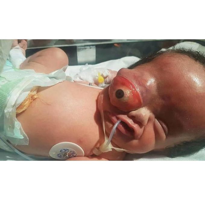 Amazing medical case