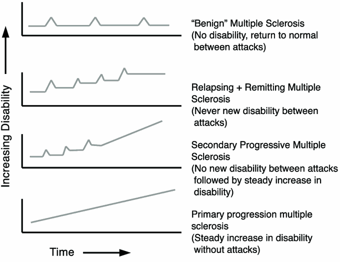 Types of Multiple Sclerosis