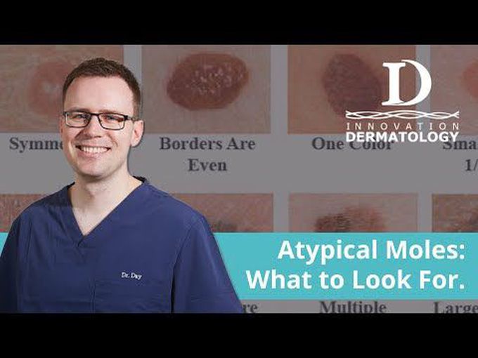 Atypical mole - What is a mole?