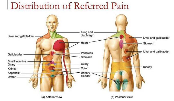 Referred Pain